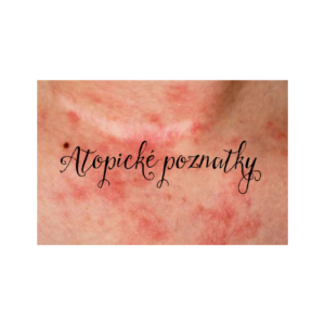 Logo Atopické poznatky